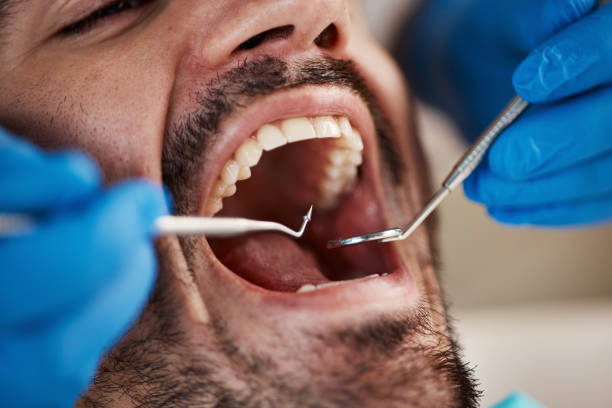 Emergency Dental Services in Stone Park, IL